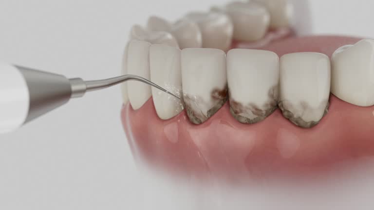 Trusted Teeth Cleaning And Checkup service in Sumrall, MS - Dentist Open Now